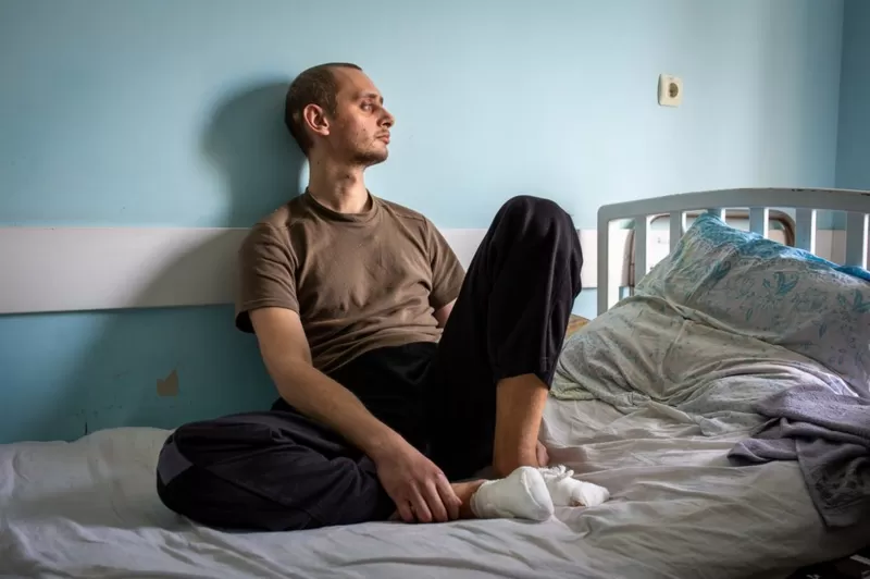 "Як я повернувся з російського полону без пальців на ногах"