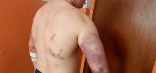 “Я був шокований, коли його побачив після звільнення": родичі в'язнів заявляють про тортури у Бердянській колонії