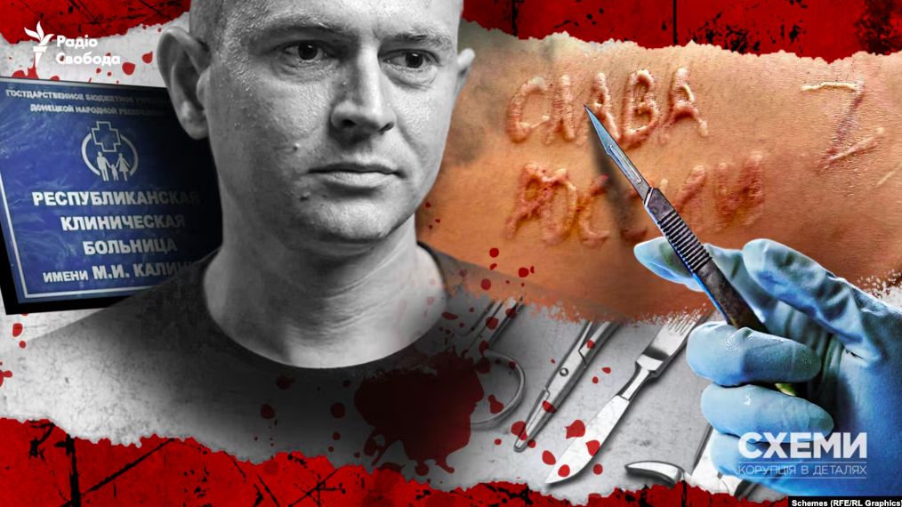 Звірячий лик рашизму: російські хірурги - кати військополонених українців (розслідування)