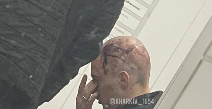 Чому мажори й надалі вбиватимуть українців