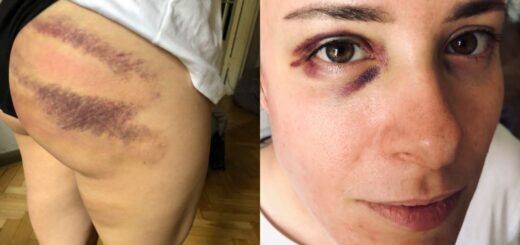 Пытки в Беларуси: "Такого не было со сталинских времен"