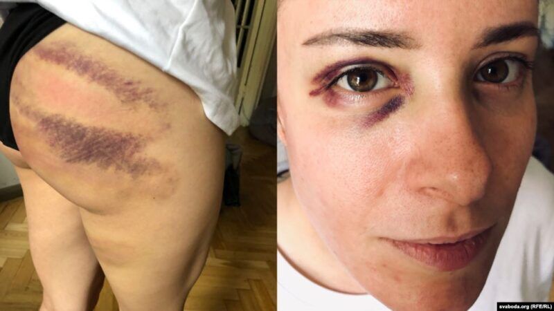 Пытки в Беларуси: "Такого не было со сталинских времен"