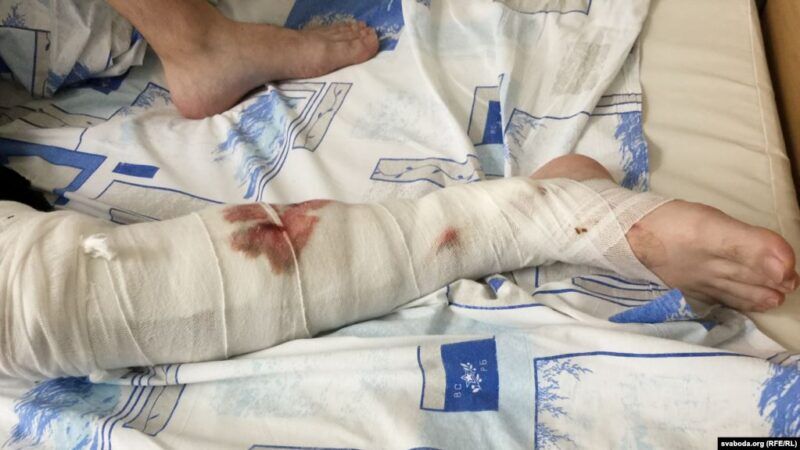 Украинский правозащитник после отсидке в белорусском изоляторе: "Рядовые милиционеры по злости не отличаются от ОМОНа"