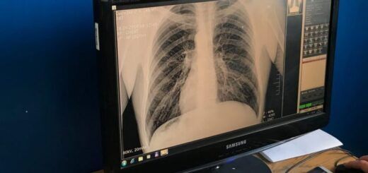 Як "лікують" в'знів в українських тюрмах