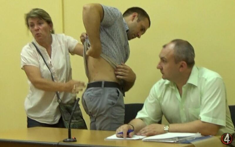 У суді, під час якого оскаржують закриття кримінального провадження щодо важких тілесних ушкоджень, мати постраждалого березнівчанина Дмитра Рощука емоційно показує слідчій сліди поранень на тілі її сина