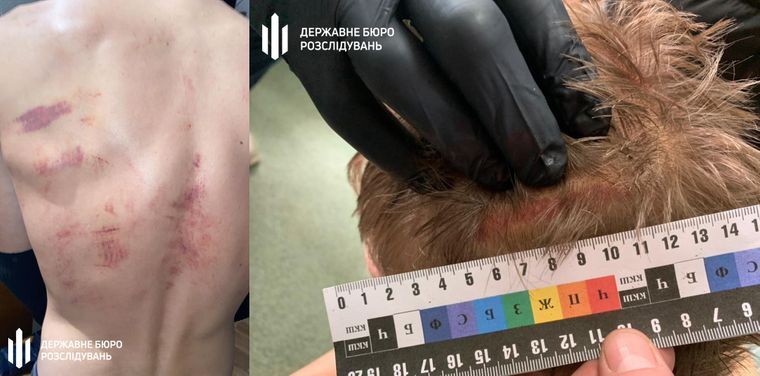 Как планируют бороться с произволом и пытками правоохранителей